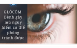 Cần kiểm tra mắt định kỳ để phát hiện sớm bệnh Glôcôm