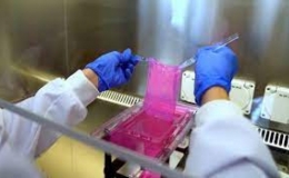 Máy chế tạo da ghép cho bệnh nhân bỏng