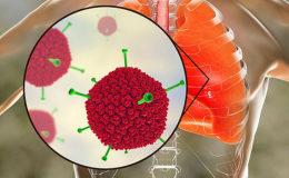 Diễn biễn các ca mắc mới, nguy kịch do virus Adeno gia tăng