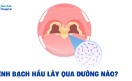 Đường lây truyền bệnh bạch hầu