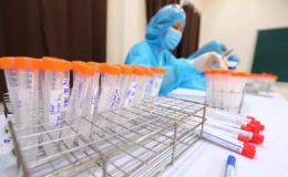Một nhân viên y tế ở Hải Phòng dương tính với SARS-CoV-2