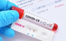 Chính phủ gia hạn thời gian thanh tra mua sắm kit xét nghiệm, vaccine COVID-19