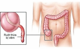 Ruột thừa có thừa hay không? Những điều cần biết về ruột thừa