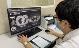 Các việc nên làm để tránh tình trạng "sương mù não" của hậu COVID-19