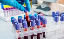 Hơn 40% người Việt có cholesterol máu cao