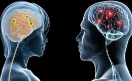Những dấu hiệu thiếu máu não