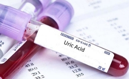 6 cách giảm nồng độ axit uric tự nhiên