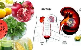 Bác sĩ gợi ý những thực phẩm “vàng” giúp phòng sỏi tiết niệu hiệu quả