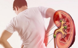 Cảnh báo dấu hiệu bệnh thận mạn tính và cách phòng ngừa