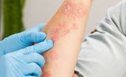 Cảnh báo gia tăng các bệnh về da trong mùa mưa