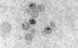 Chủng virus đậu mùa khỉ ở Ấn Độ khác với chủng ở châu Âu