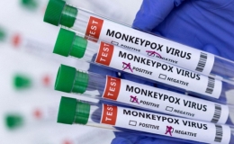 WHO đặt tên mới cho các chủng virus gây bệnh đậu mùa khỉ